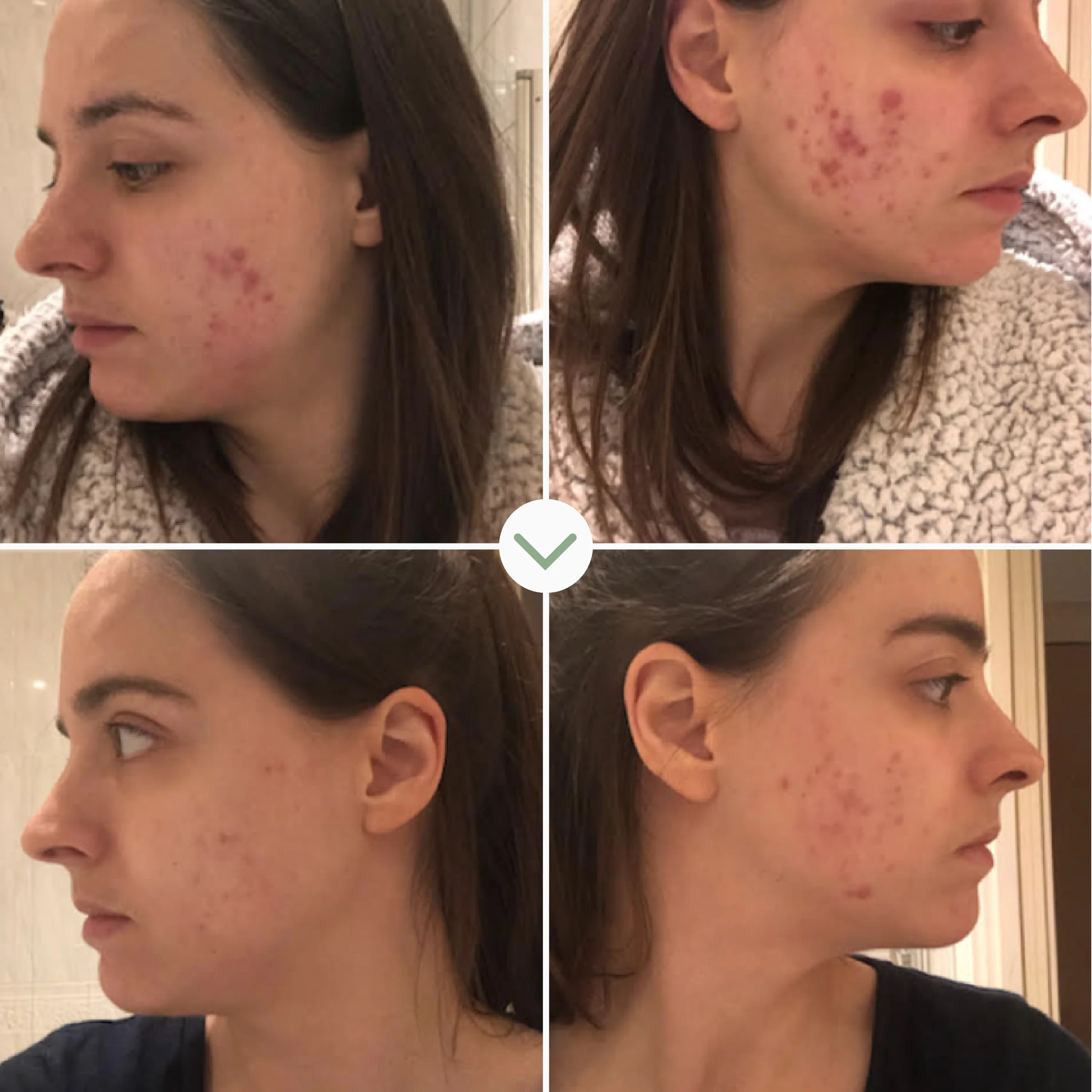 Instant Kalmer Serum - Image 4